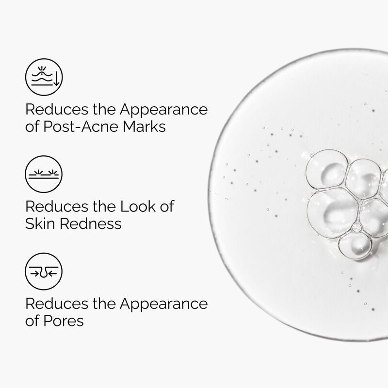 The Ordinary Aloe 2% + N-Acetyl Glucosamine 2% Solution – Original Formula