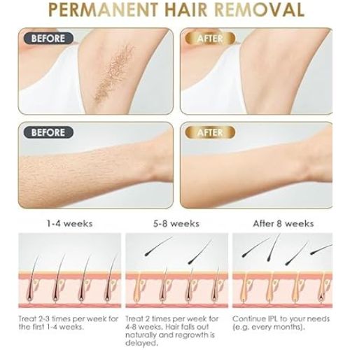 Babyverse™ IPL Hair Removal Device for Women
